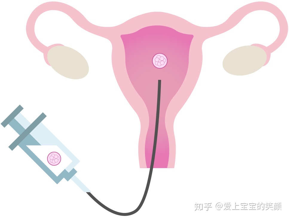 云南九洲供卵借卵做试管自怀咨询-云南九洲医院电话是多少