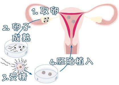 四十二岁卵巢早衰怎么办