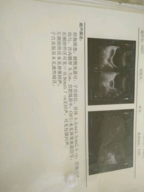 兰州中心医院试管成功率如何看待