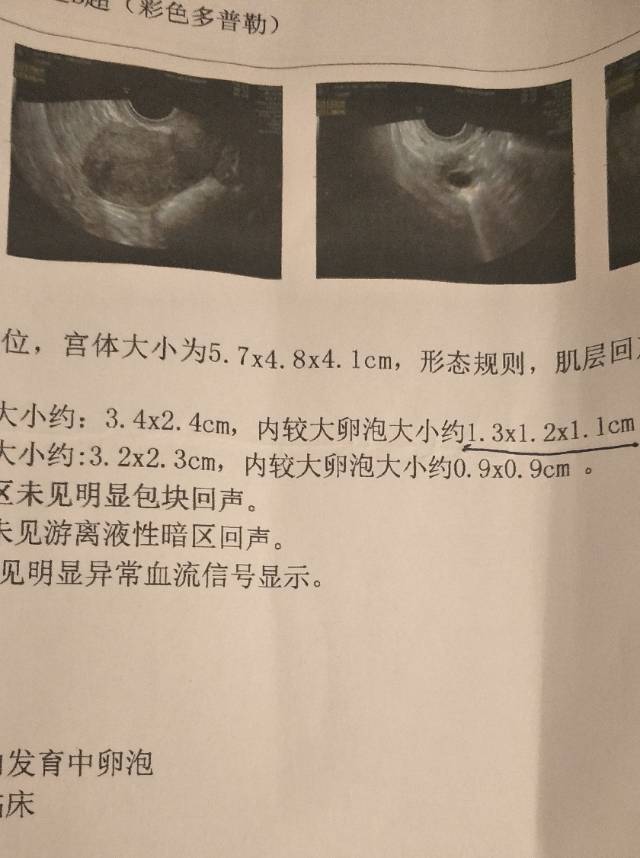 弱精症兰州可以试管代怀么成功率+弱精症单身代怀生子公司成功率高吗