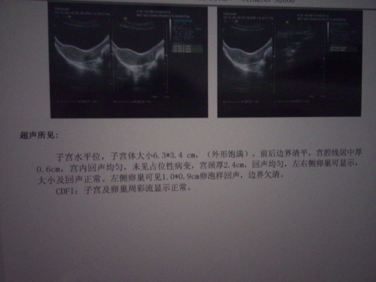 取卵前夜针为什么要打达必佳