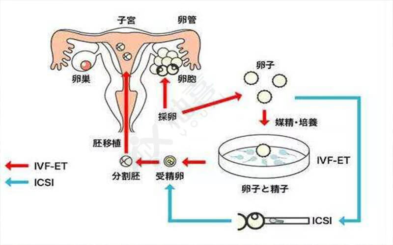 郑大三附院试管医生管一春的号好挂吗