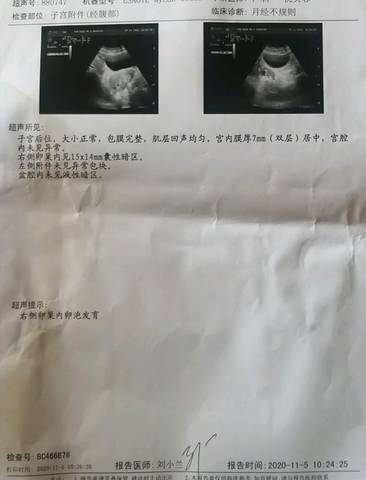 兰州供卵的话需要提前预约吗