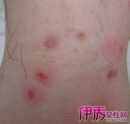 哪里有供卵子的医院+兰州哪里有供卵子医院
