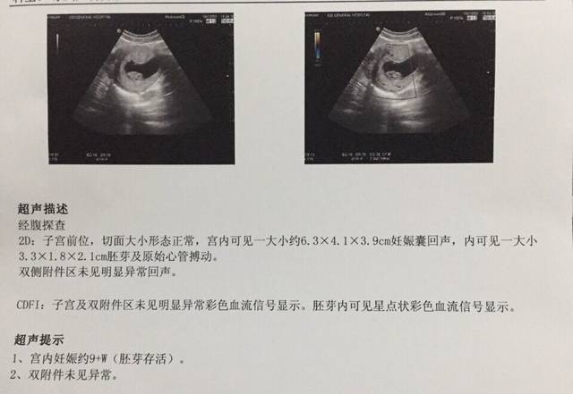 2024兰州专业代生助孕医院排名,成功率最高还得看妇幼